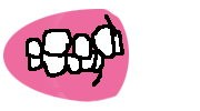 Buck teeth