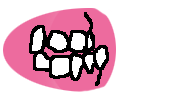 Underbite